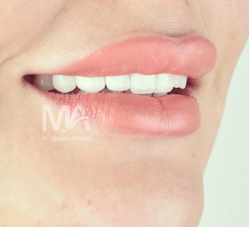 عيادة اللاذقية لطب الأسنان تجميل وزراعة أسنان