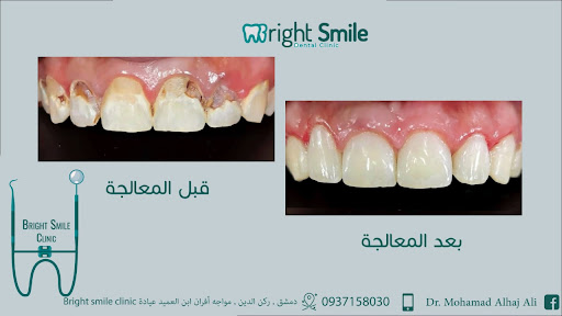 عيادة الإبتسامة المشرقة لطب الأسنان