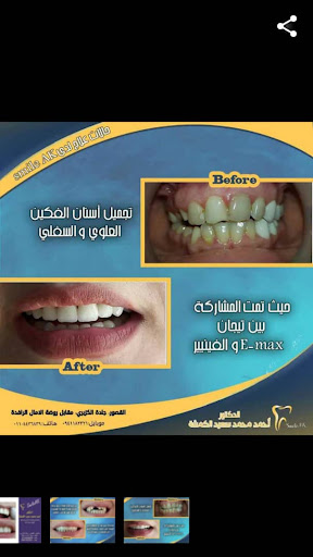 Smile AK clinic الدكتور احمد الكمشة