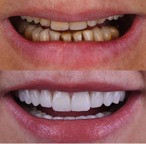 العيادة السنية لتبييض وتجميل الأسنان