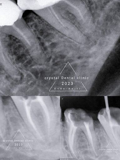 كريستال لمعالجة وتجميل الاسنان د. مصطفى النجار