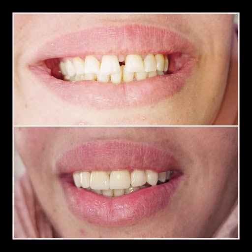 عيادة الدكتور محمد المحاميد لطب الأسنان