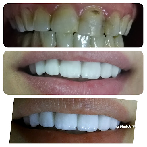 عيادة الدكتور محمود سليمان زعرورة لطب وتجميل الأسنان