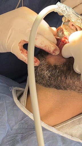 مركز الدكتور احمد علي لزراعة الأسنان