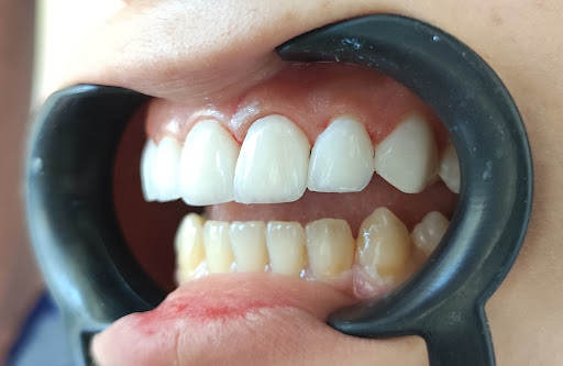 د.تميم السهو